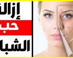 اسعار علاج حب الشباب بالليزر - اكثر المشكلات التى تواجه الشباب