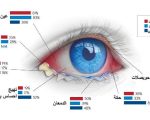 علاج الرمد , طريقة فعالة لعلاج الرمد