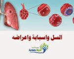 علاج مرض السل , معنا ستضمن القضاء علي شبح السل نهائيا