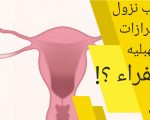 افرازات صفراء من المهبل , ماهي الافرازات الصفراء وماهو سببها