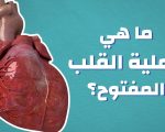 ما هي عملية القلب المفتوح- تعرفوا بكل سهوله على عمليات القلب المفتوح