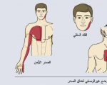 الم بالصدر الايسر , لا تتاخرى فى معالجة هذه المشكلة