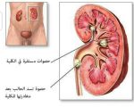 اعراض امراض الكلى , هذه الاعراض واضحة