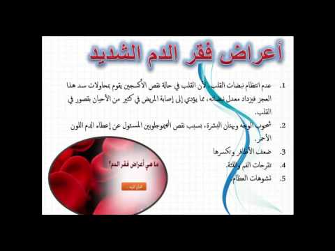 5722 اعراض فقر الدم - الاعراض بسبب فقر الدم حاتم تميم