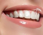 كيفية تبييض الاسنان , طرق تبييض الاسنان بكل سهوله