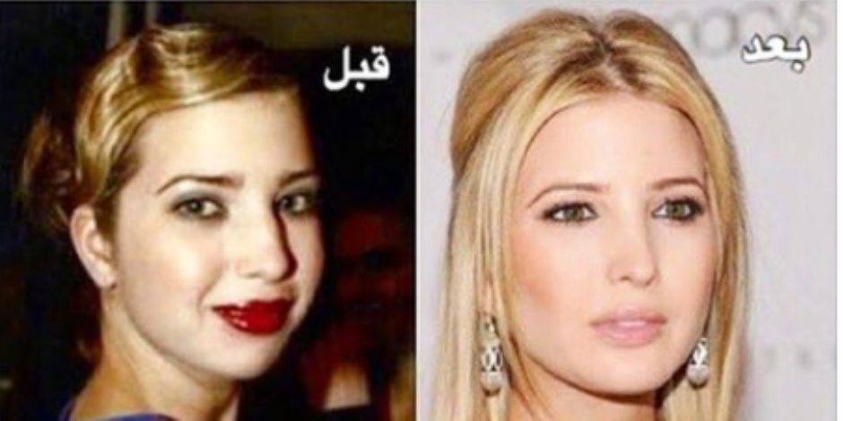 صور بنت ترامب , صور بنت ترامب قبل وبعد عمليات التجميل