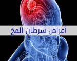 اعراض سرطان الدماغ