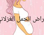 ما هو الحمل الغزلاني وماهي اعراضه, تعرفي على الحمل الغزلاني وجميع الاعراض