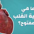 13048 3 ما هي عملية القلب المفتوح- تعرفوا بكل سهوله على عمليات القلب المفتوح اريام بخيت