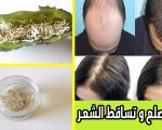 علاج سقوط الشعر, اسباب واعراض وعلاج الشعر المتساقط
