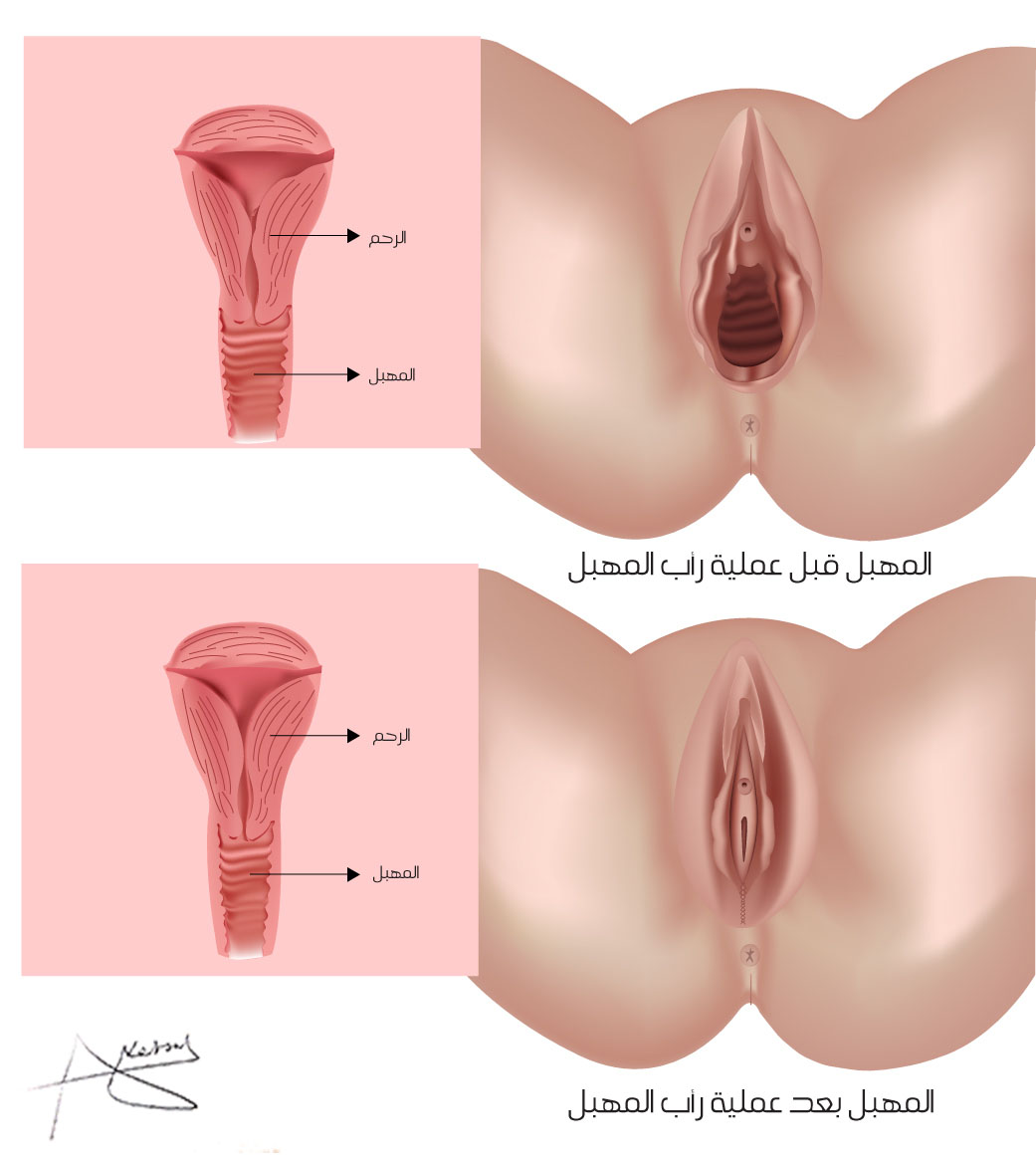 сокращается ли матка во время оргазма фото 12